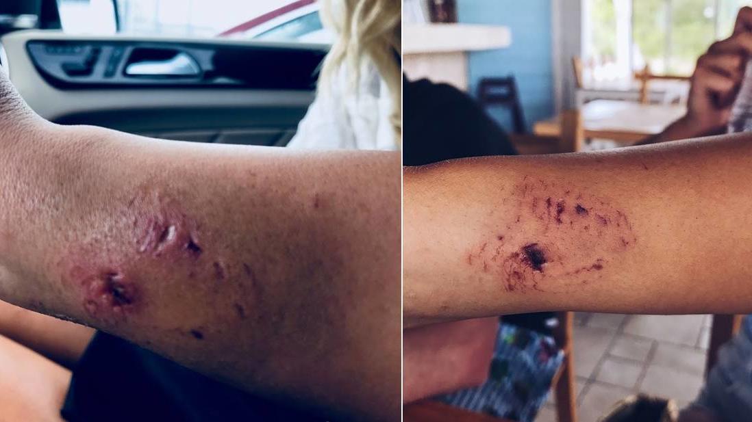 Instagram-Model Katarina Zarutskie bei Shooting von Hai gebissen Katarina Zarutskie