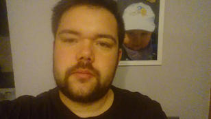 Michael hat neue Probleme mit seinem Fuß Michael hat neue Probleme mit seinem Fuß