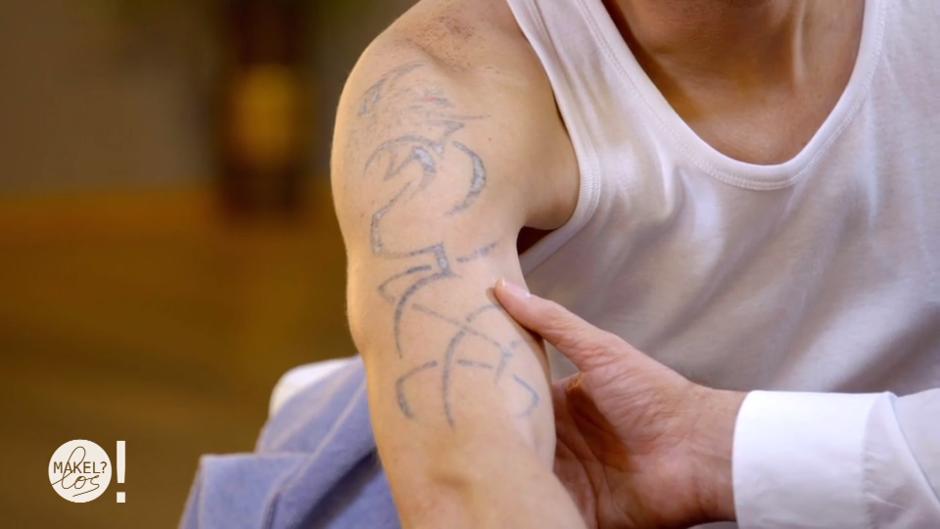 Floyd möchte sein Tattoo überdecken Floyd möchte sein Tattoo überdecken