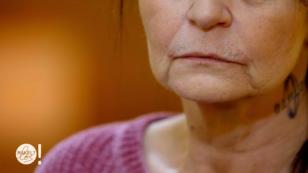 "Meine Oberlippe macht mich älter" "Meine Oberlippe macht mich älter"