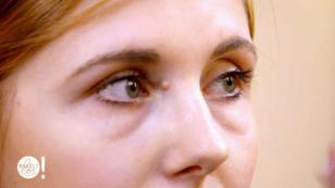 Lisa hat schlimme Augenringe Lisa hat schlimme Augenringe