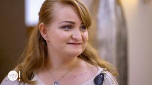 Katja möchte ihre Narbe verdecken Katja möchte ihre Narbe verdecken