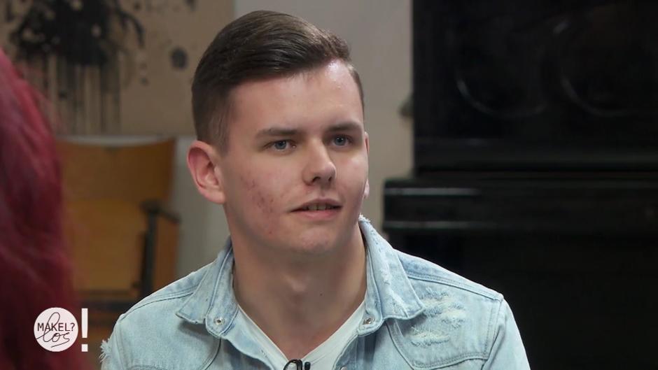 Yannik möchte seine Aknenarben loswerden Yannik möchte seine Aknenarben loswerden
