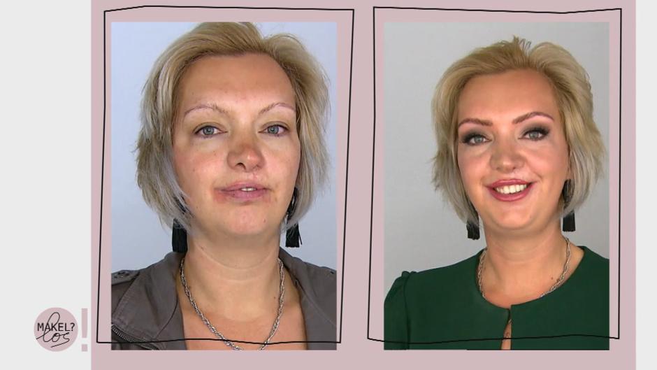 Von den Narben ist kaum noch etwas übrig Von den Narben ist kaum noch etwas übrig