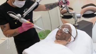 Wie funktioniert so ein Carbon-Peeling eigentlich? Wie funktioniert so ein Carbon-Peeling eigentlich?