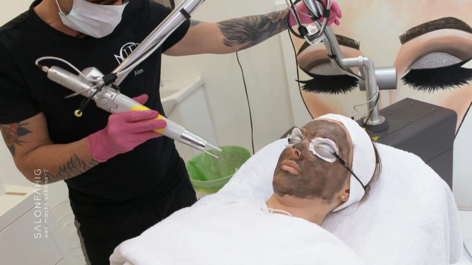Wie funktioniert so ein Carbon-Peeling eigentlich? Wie funktioniert so ein Carbon-Peeling eigentlich?