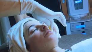 Ninas Gesicht ist haarfrei und aufgepolstert Ninas Gesicht ist haarfrei und aufgepolstert