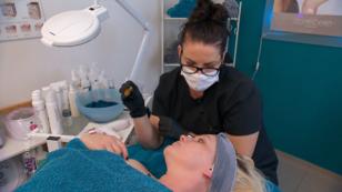 Nano-Needling macht die Haut frisch Nano-Needling macht die Haut frisch