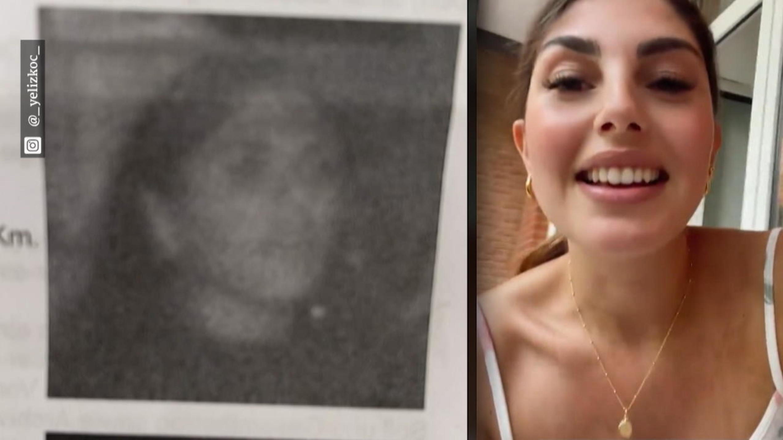 Yeliz Koc und das Blitzerfoto Yeliz Koc und das Blitzerfoto
