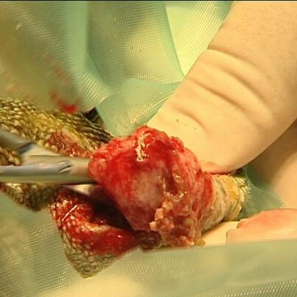 sprechstunde1 entfernung tumor sprechstunde1 entfernung tumor