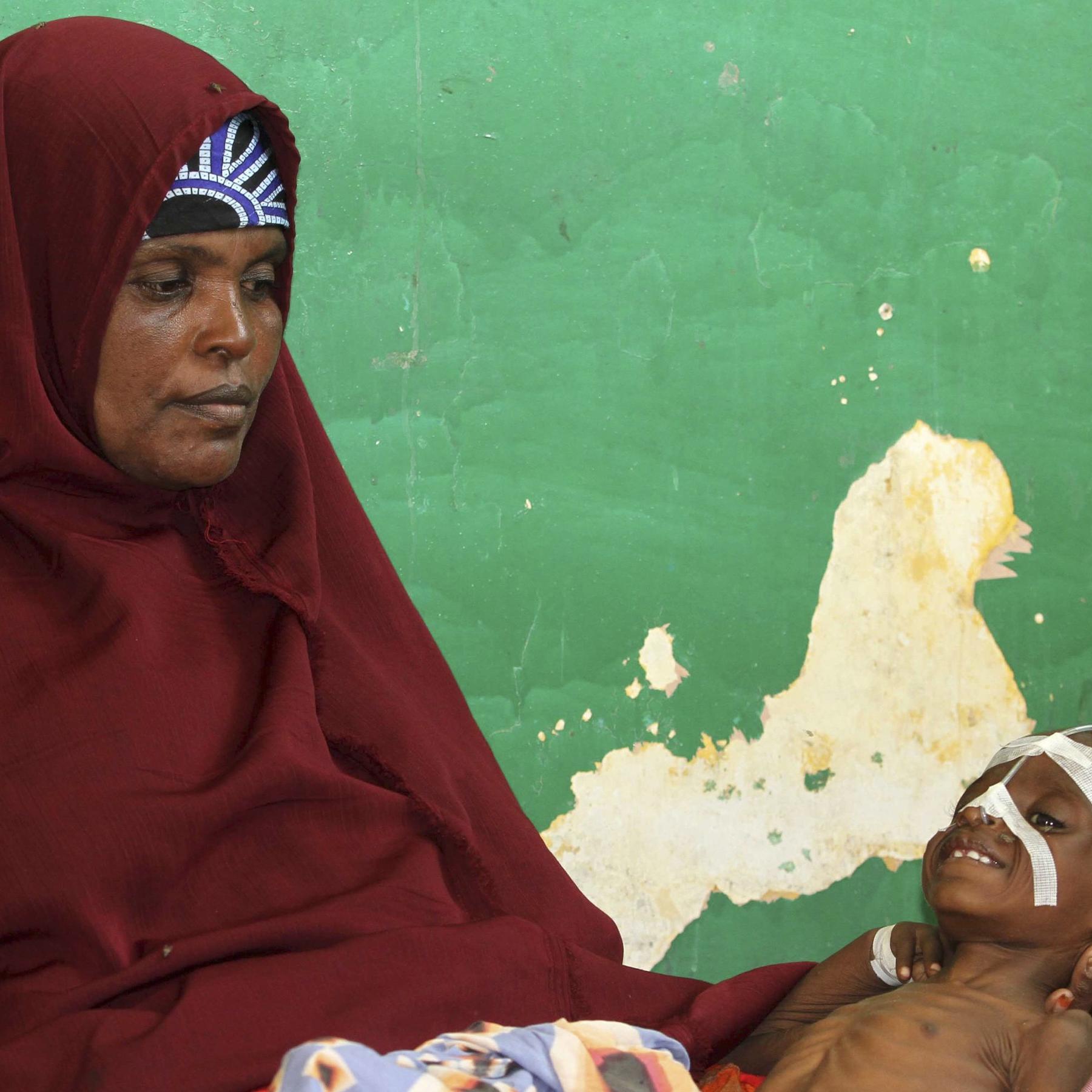An internally displaced woman holds her malnourished son at the Banadir hospital in Somalia's capital Mogadishu An internally displaced woman holds her malnourished son at the Banadir hospital in Somalia's capital Mogadishu