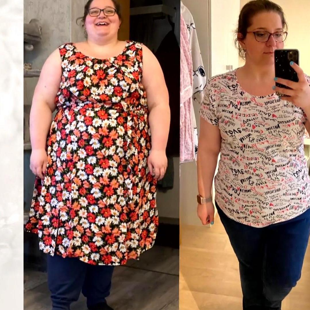 Für Melanie blieb nur noch der Ausweg Magen-OP Für Melanie blieb nur noch der Ausweg Magen-OP