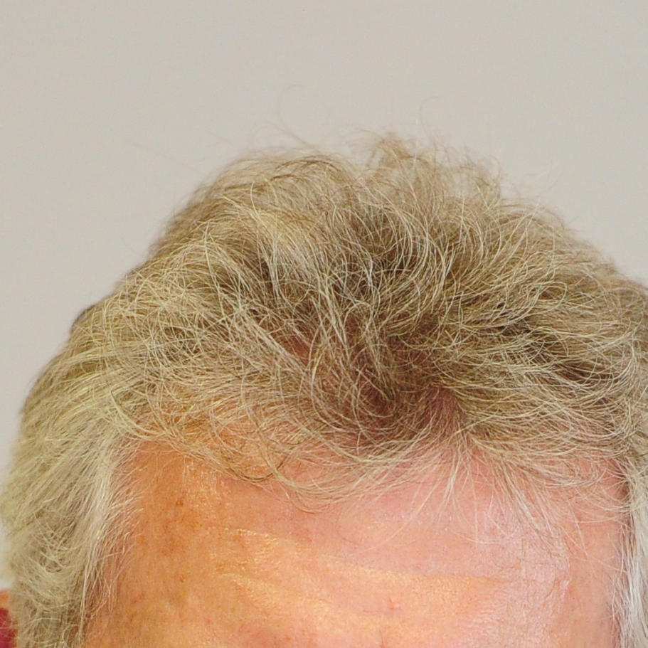 Paul Breitner Paul Breitner