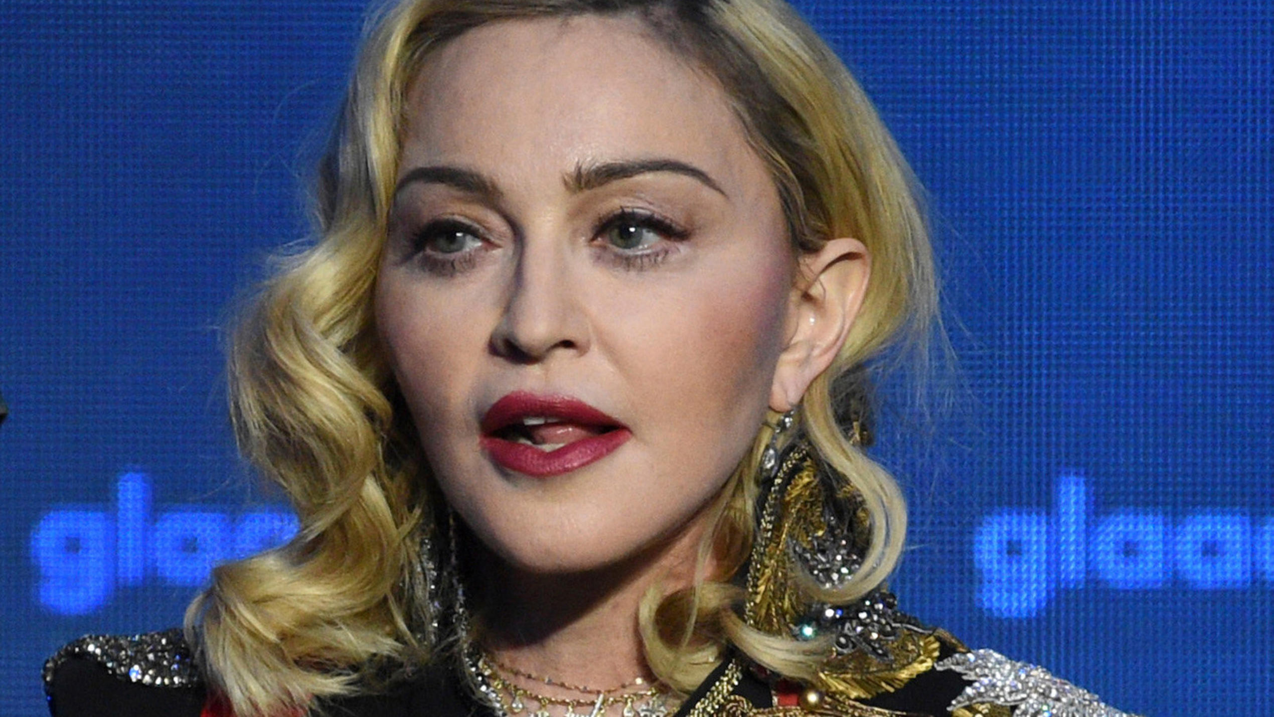 Madonna Enthullt Riesige Narbe An Der Hufte Und Bezeichnet Sich Als Uberlebende