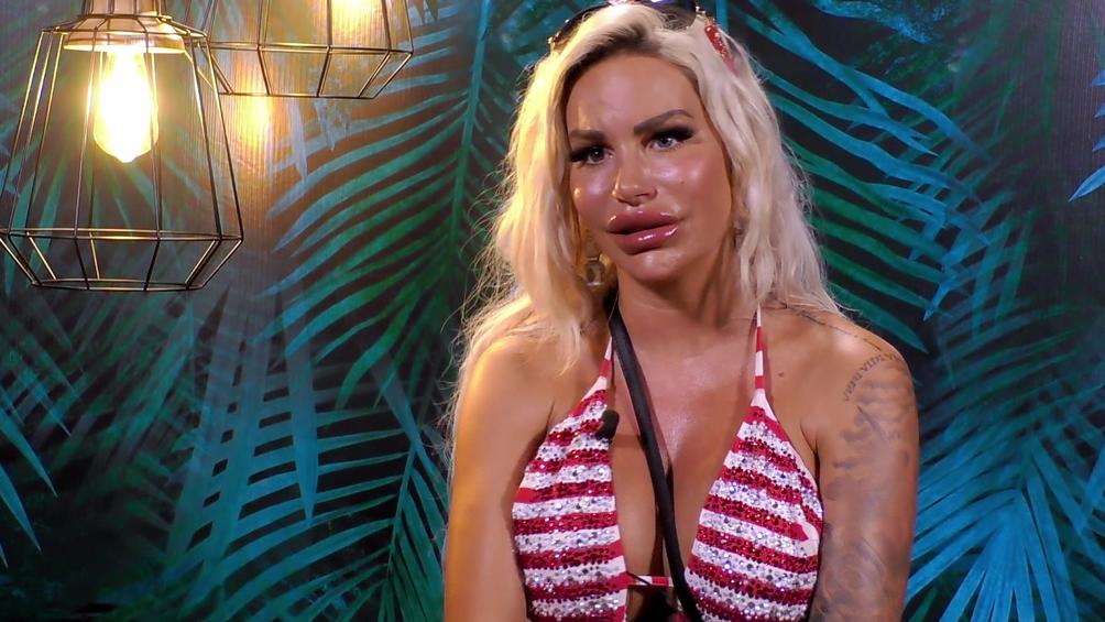 Kampf Der Realitystars Was Ist Mit Deinen Lippen Passiert Gina Lisa Lohfink