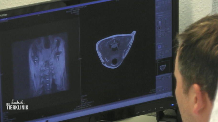 Können die Bilder einen Tumor ausschließen?