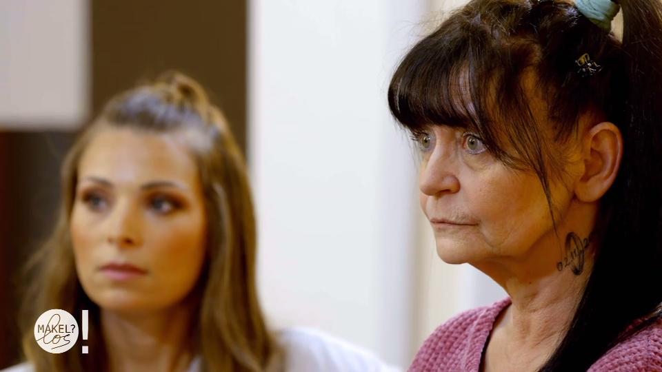 "Meine Oberlippe macht mich älter"