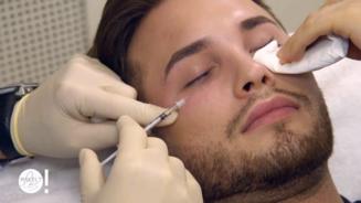 Maxim bekommt Mesobotox gespritzt