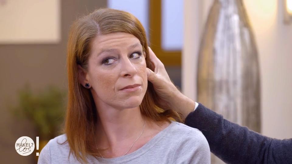 Nicole hat ein Akneproblem