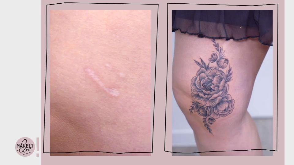 Ein Cover Up soll die Narbe verstecken