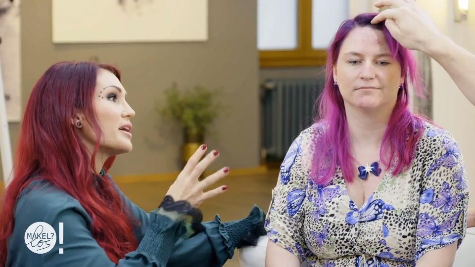 Bianca leidet unter Akne