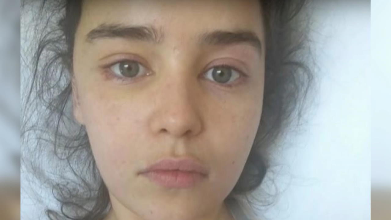 Emilia Clarke zeigt Bilder nach Hirn-OP