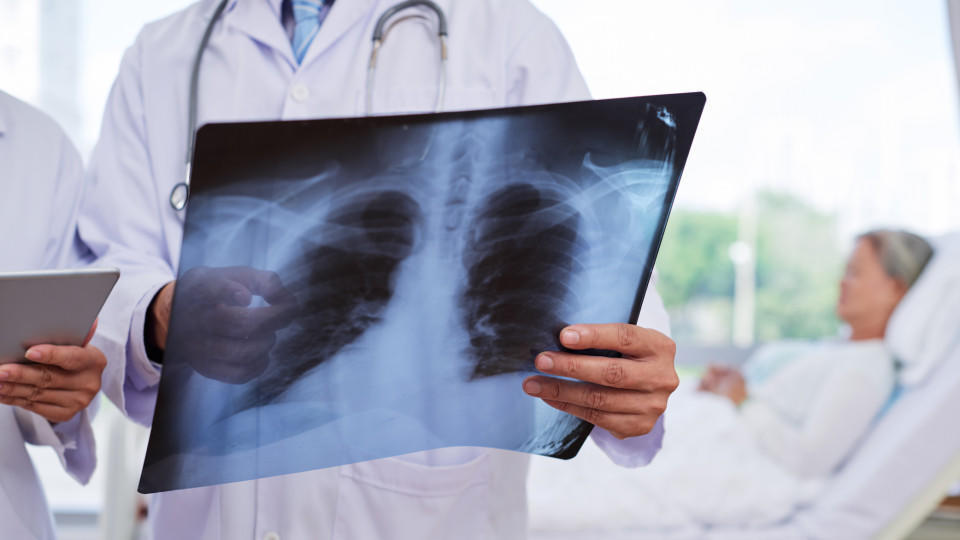 Lungenentzündung: Ursache und Behandlung