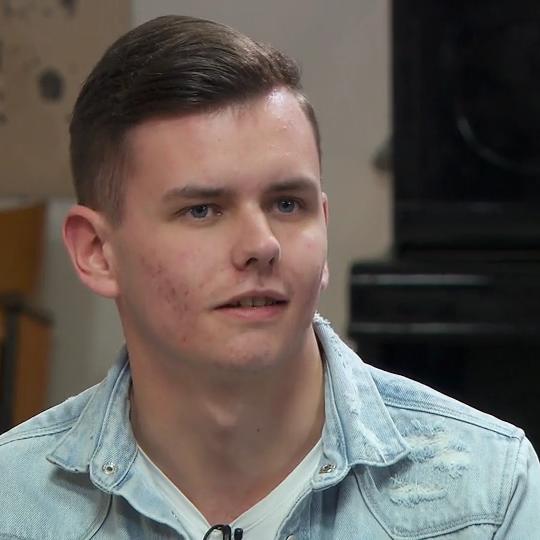 Yannik möchte seine Aknenarben loswerden