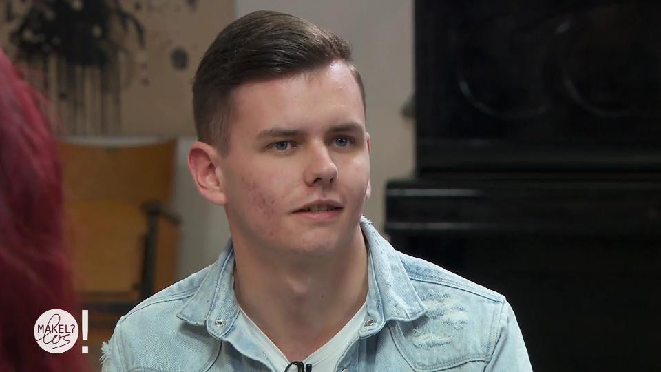 Yannik möchte seine Aknenarben loswerden