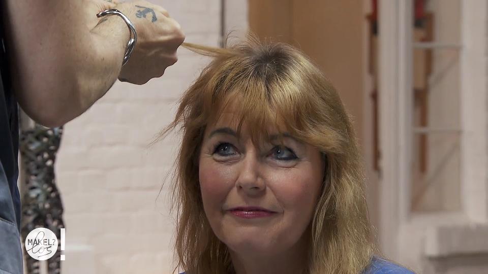 Biggi hat durch einen Haarbrand Haare verloren