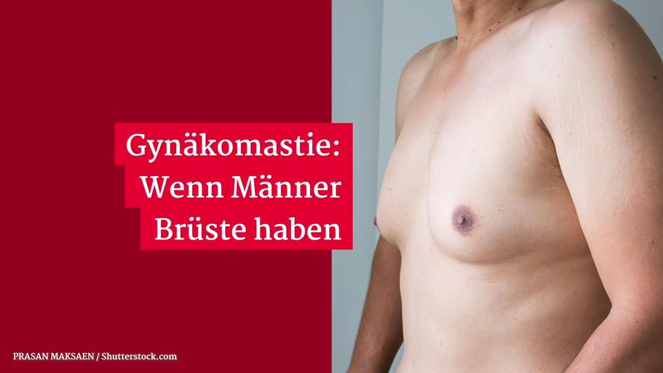 Gynäkomastie: Wenn Männer Brüste haben