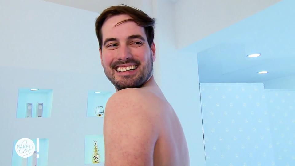 Daniel ist von seinen Rückenhaaren befreit