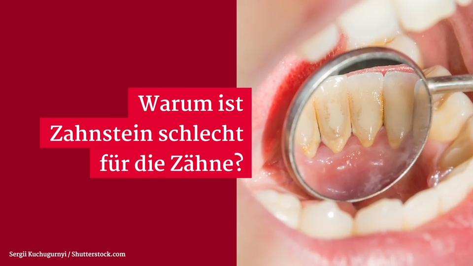 Warum ist Zahnstein schlecht für die Zähne?