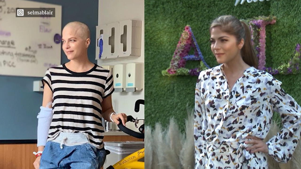 Selma Blair zeigt sich erstmals mit Glatze
