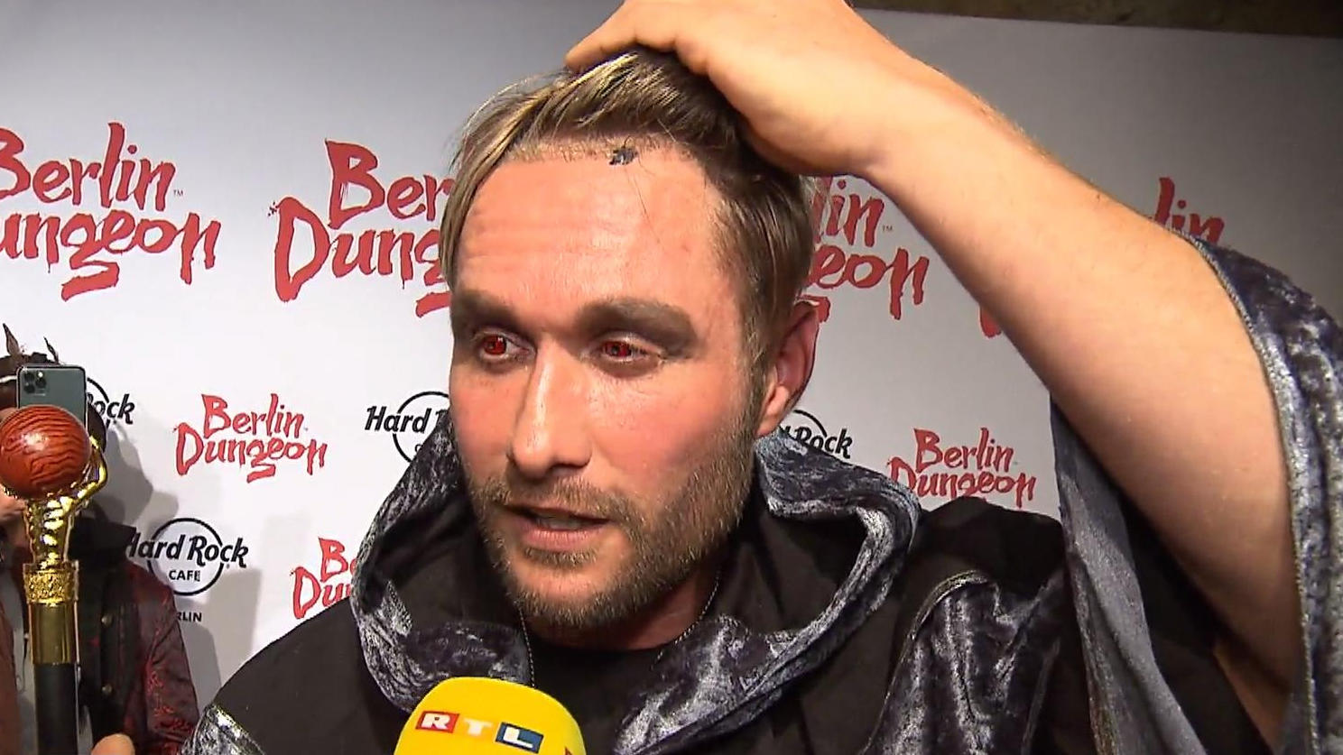 Nico Schwanz hat sich Haare transplantieren lassen