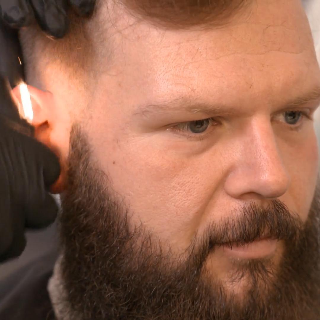 Hier werden Haare mit dem Feuerzeug entfernt