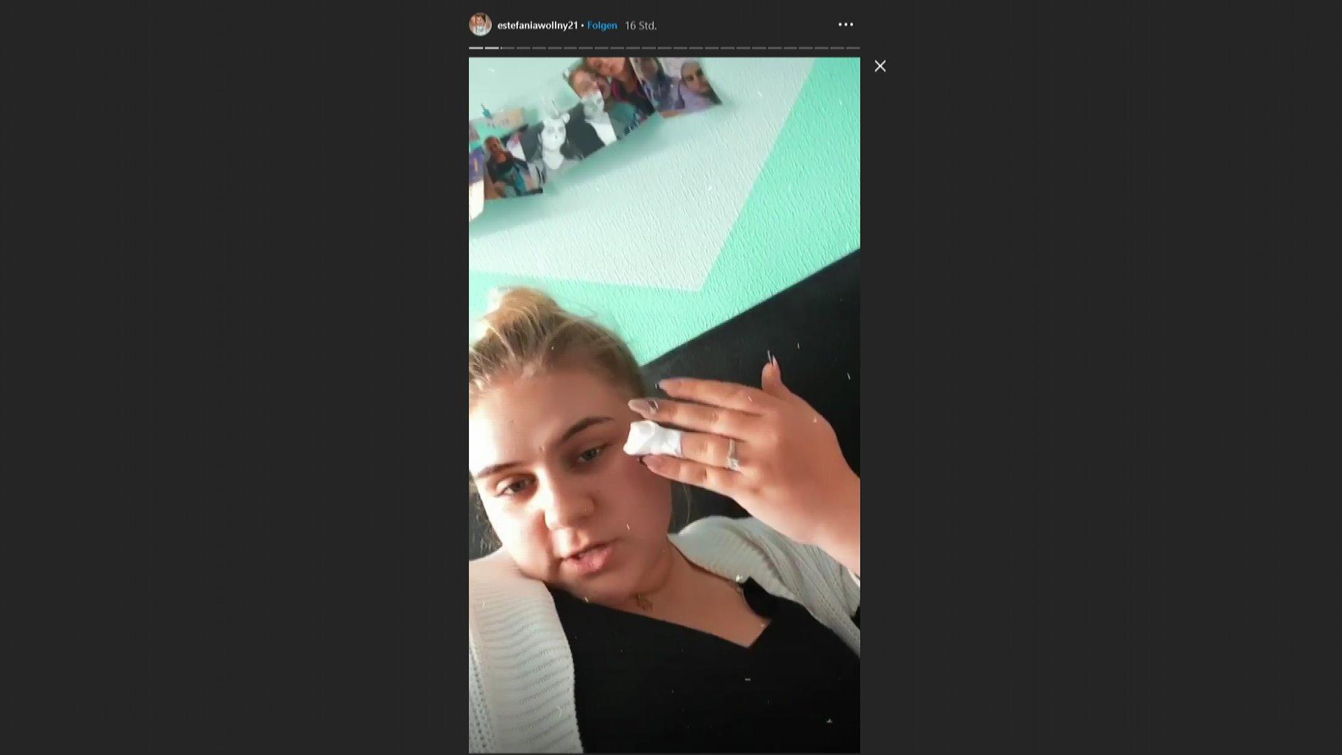 Estefania Wollny mit schlimmer Beauty-Verletzung