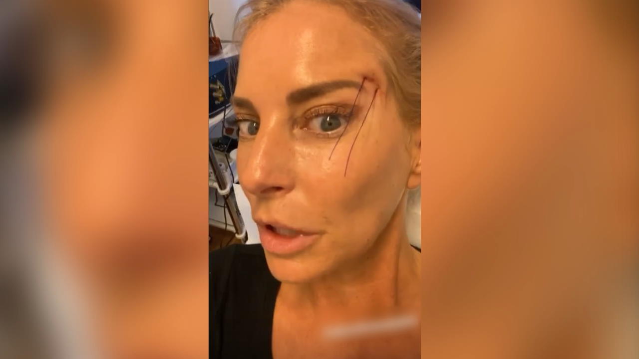 Giulia Siegel nimmt ihre Follower mit zum Beauty-Doc
