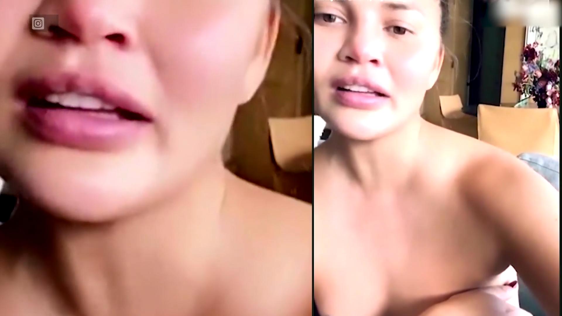 Chrissy Teigen zeigt ihre Brust nach der OP
