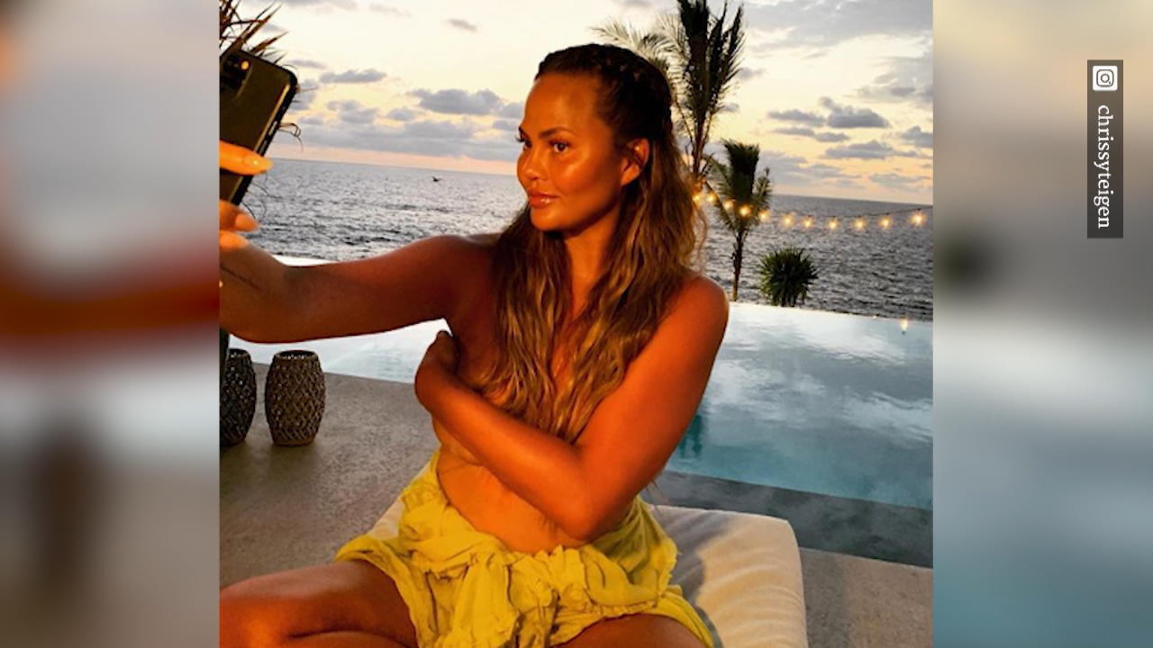 Lässt sich Chrissy Teigen ihre Brüste noch einmal verkleinern?