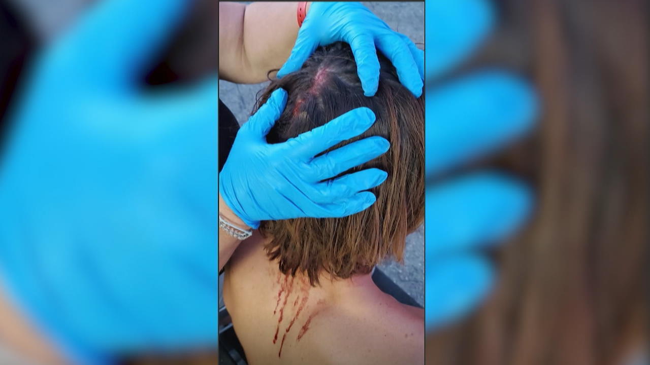 Riverdale-Schauspieler verletzt sich am Set