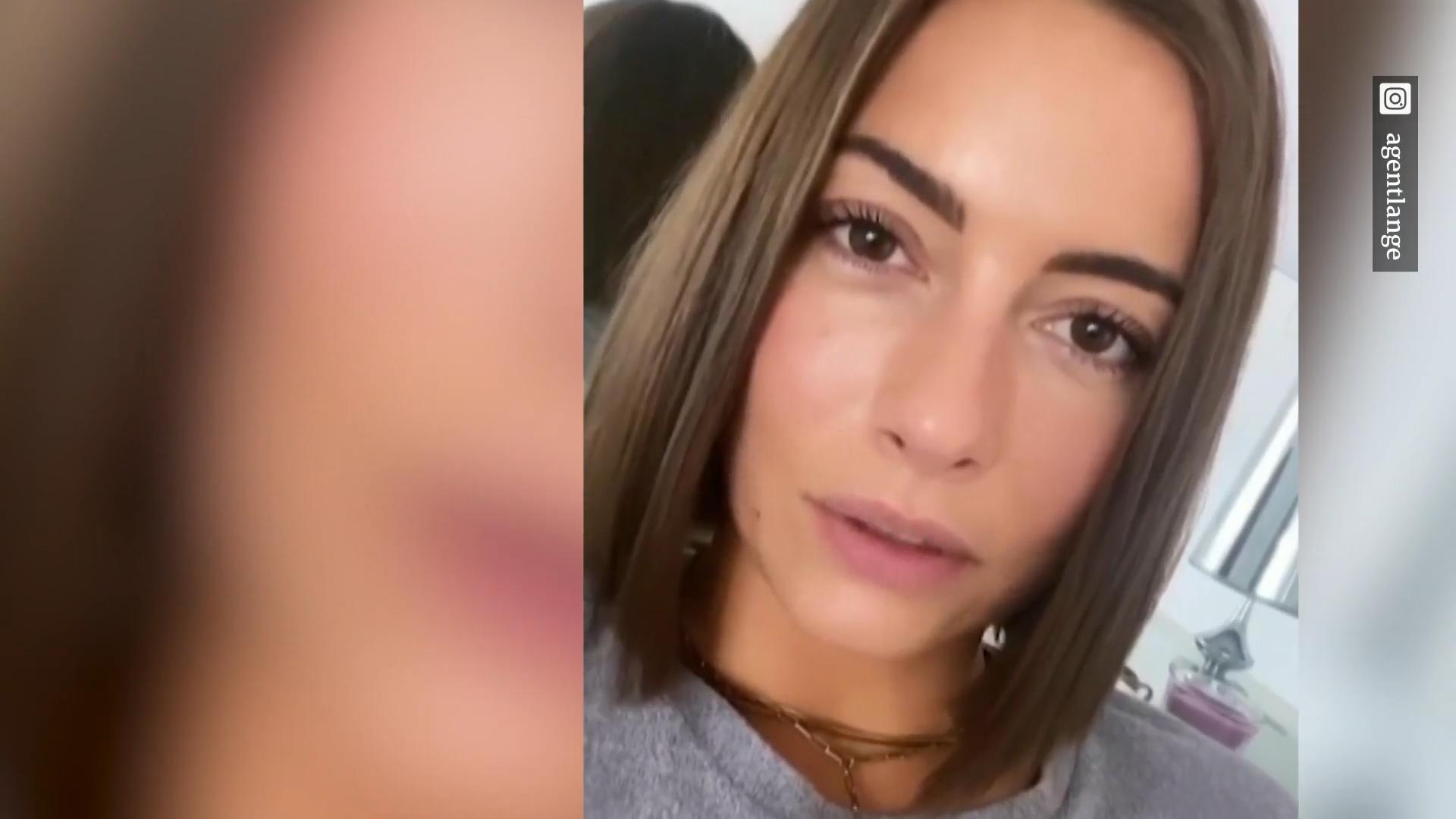 Jennifer Lange entschuldigt sich für ihr Verhalten