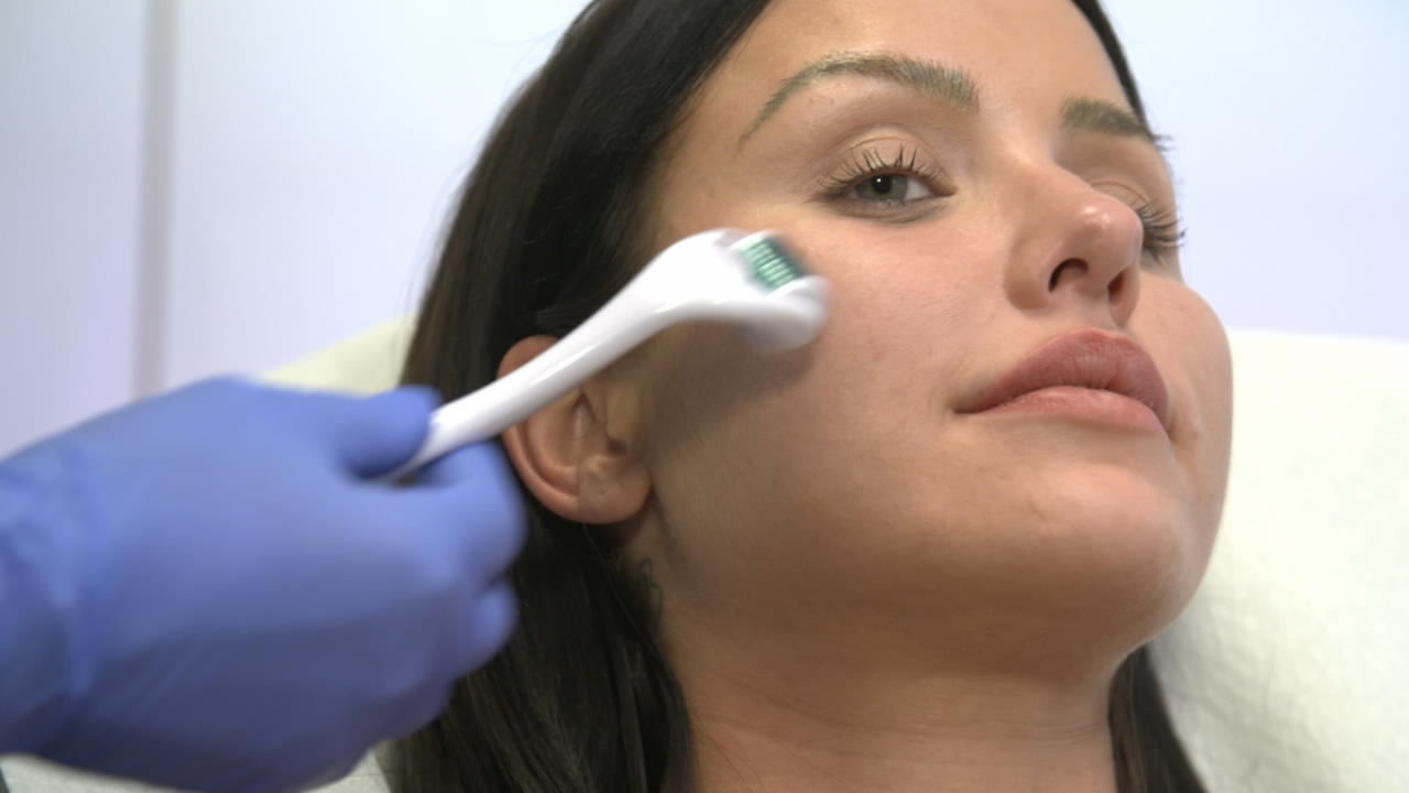 Darum lässt Kim Gloss so viele Schönheitseingriffe machen