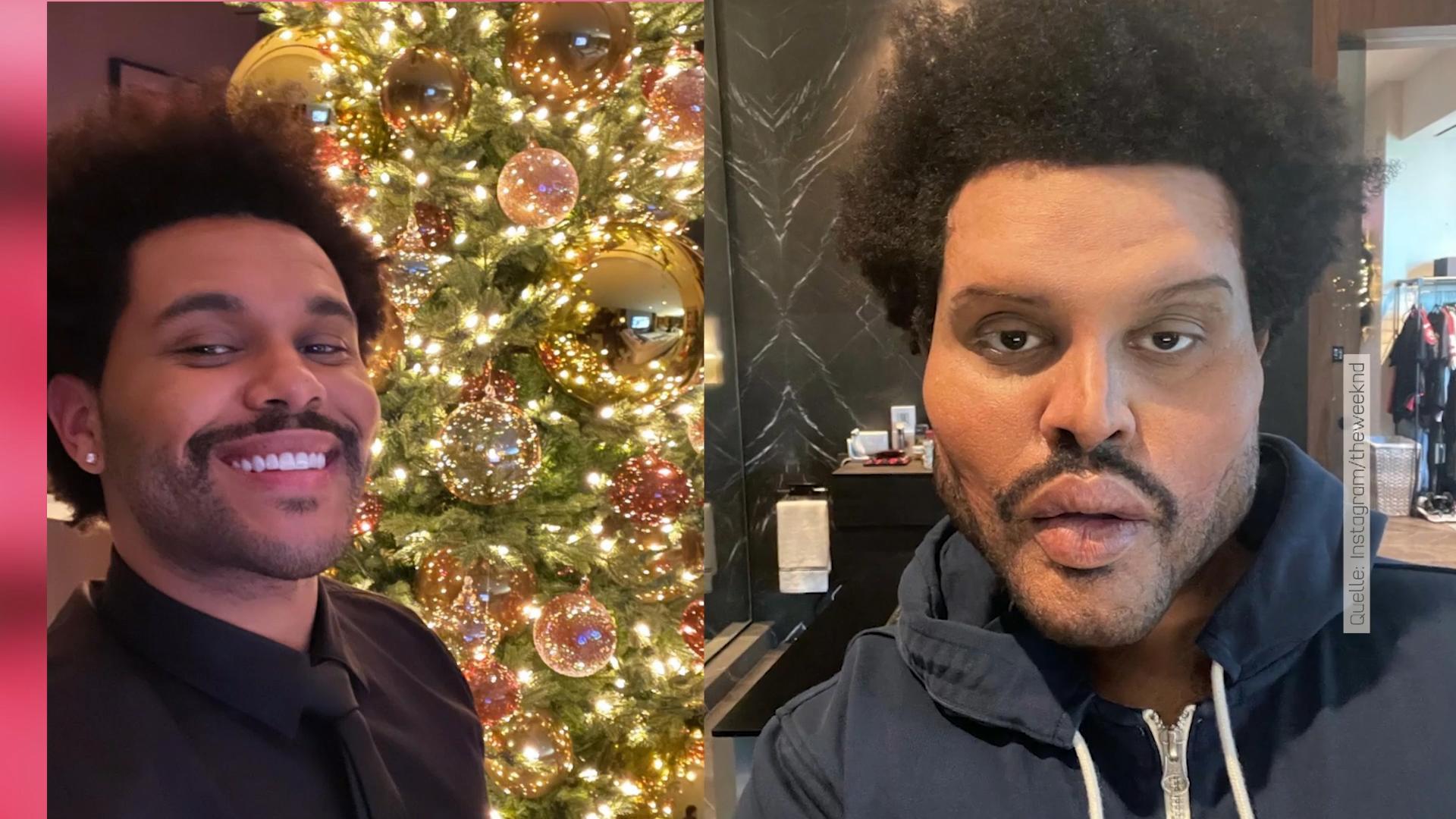 Sänger The Weeknd sieht plötzlich ganz verändert aus!