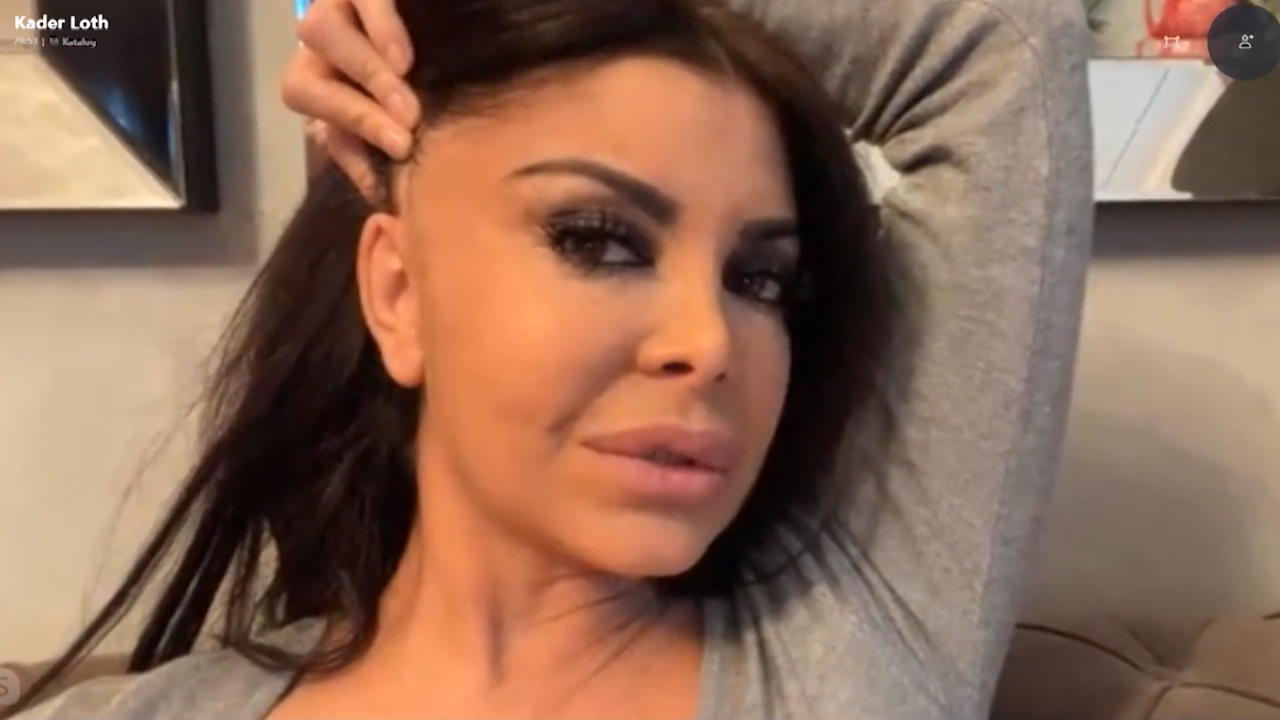 Kader Loth fallen die Haare aus