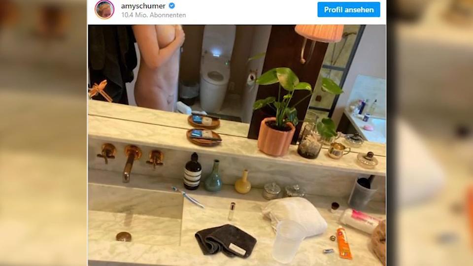 Amy Schumer zeigt die ungeschönte Wahrheit