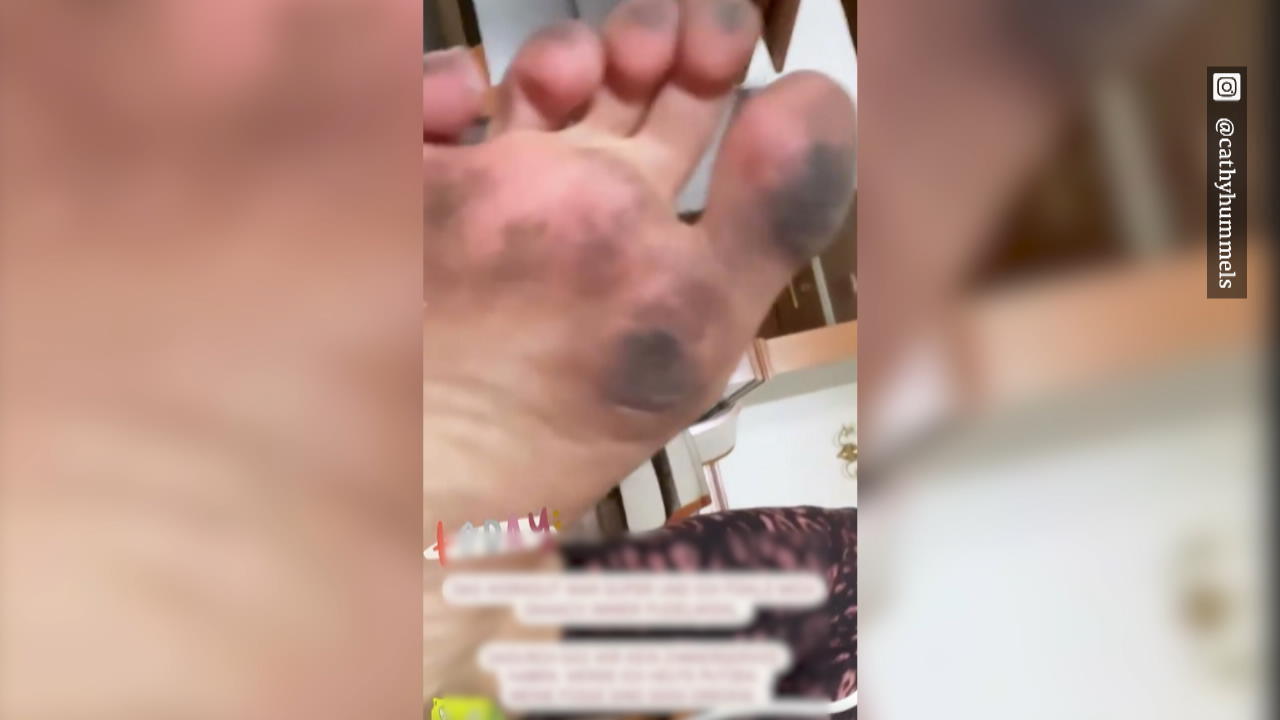 Ekel-Bericht aus ihrem Hotelzimmer in Thailand