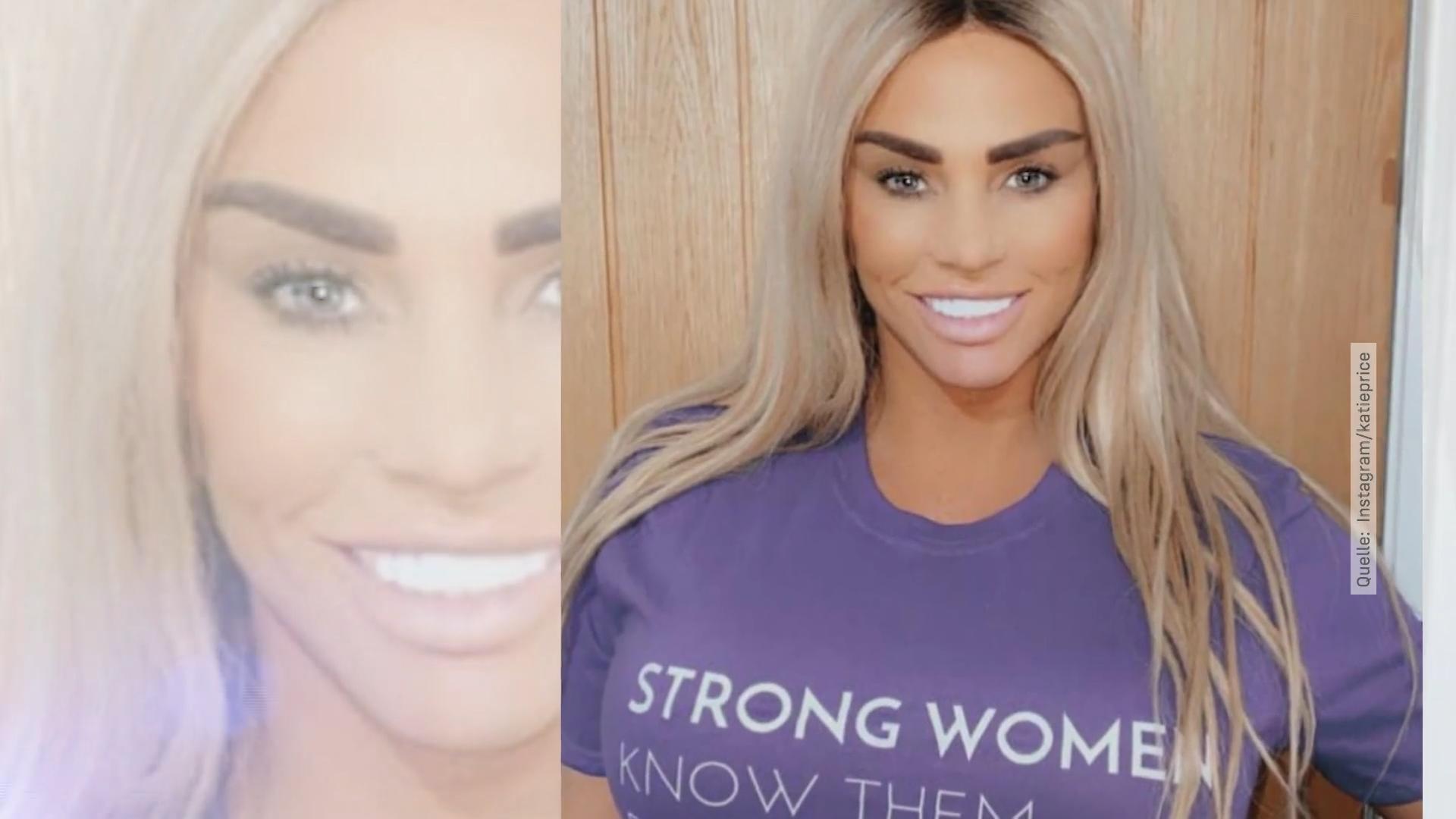 Katie Price & Co.: Stars mit (und ohne) Perücke