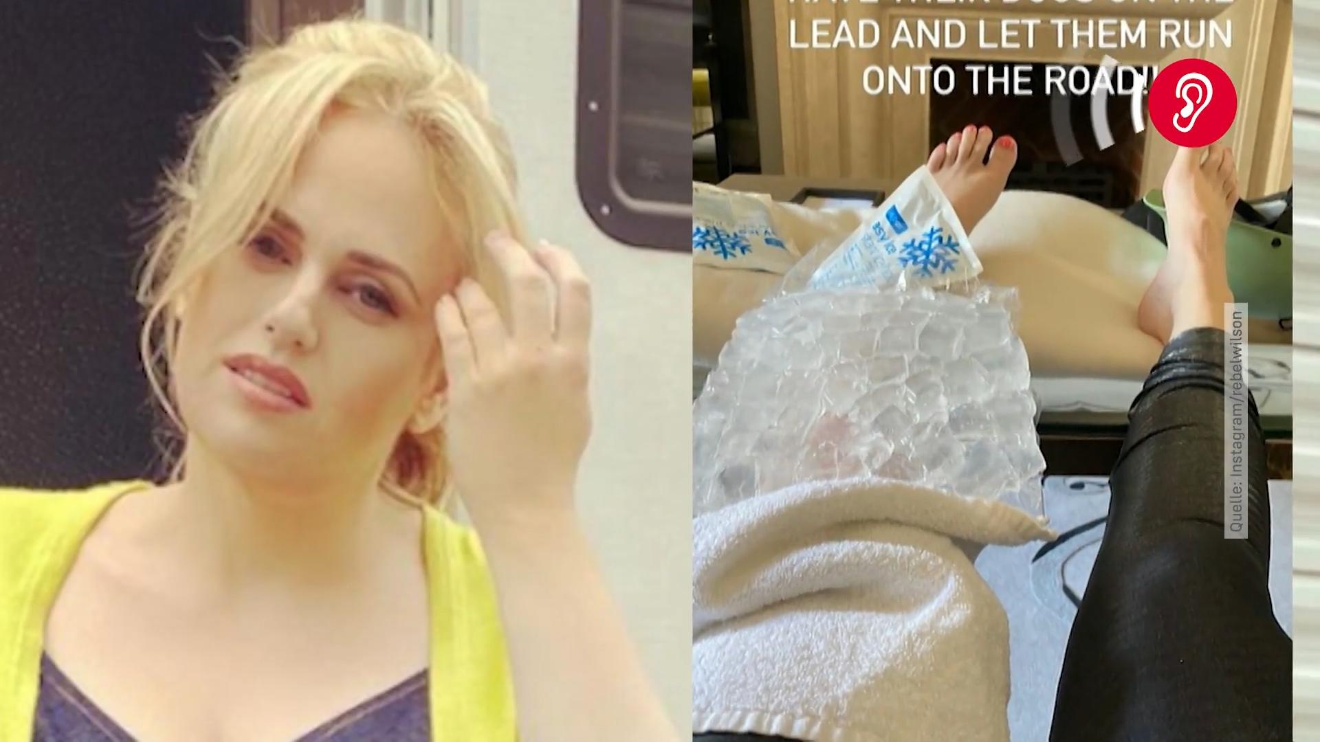 "Pitch Perfect"-Star Rebel Wilson erleidet Fahrradunfall