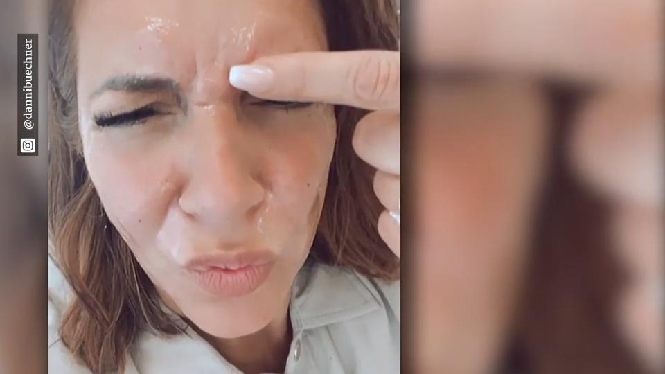 Danni Büchner lässt sich botoxen